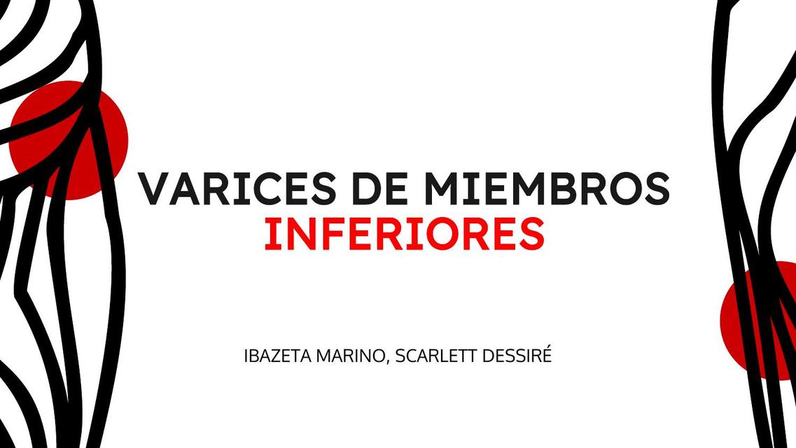 Varices de Miembros Inferiores 