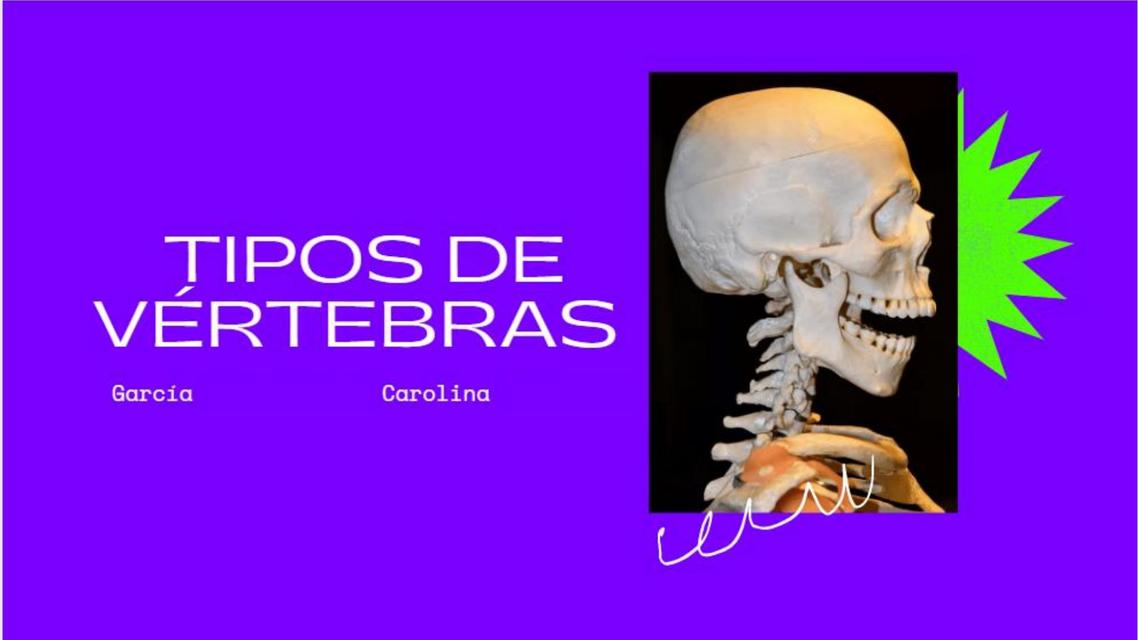 Tipos de Vertebras