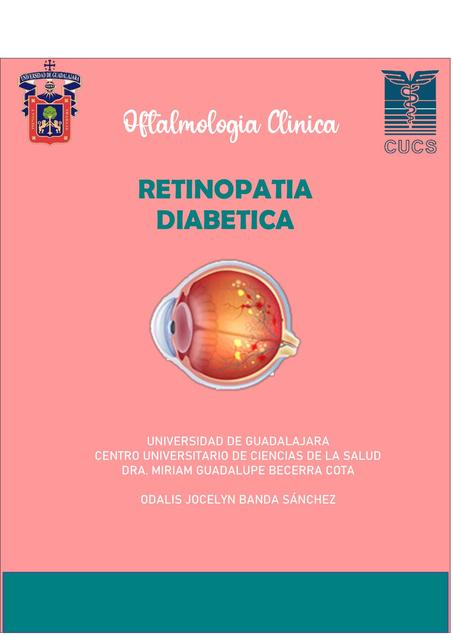 Retinopatía Diabética