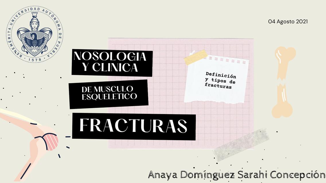 Fracturas