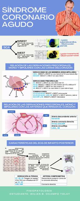 Síndrome Coronario Agudo Relación con Electrocardiograma y su Tratamiento según la Fisiopatología