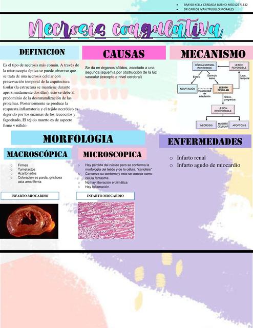 Necrosis Coagulativa 