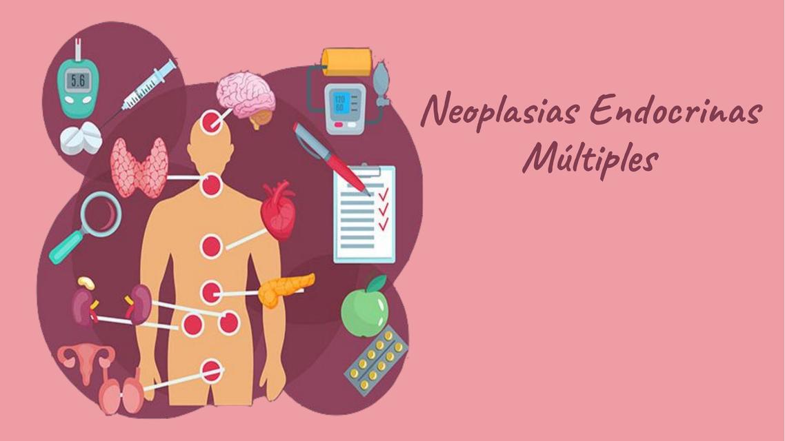 Neoplasias Endocrinas Múltiples