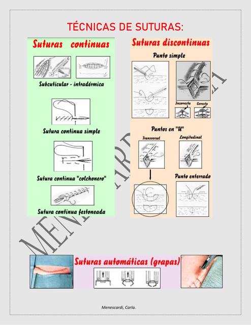 Técnicas de Suturas