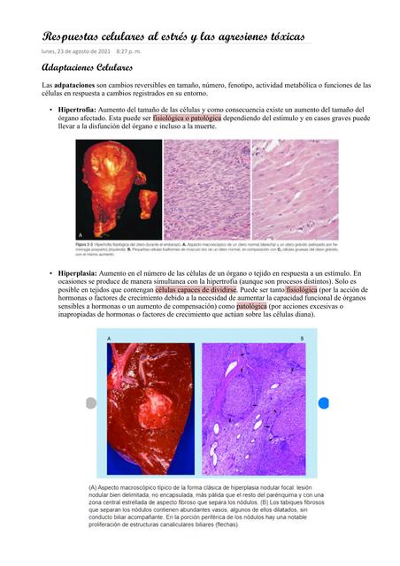 Adaptación y Lesión Celular