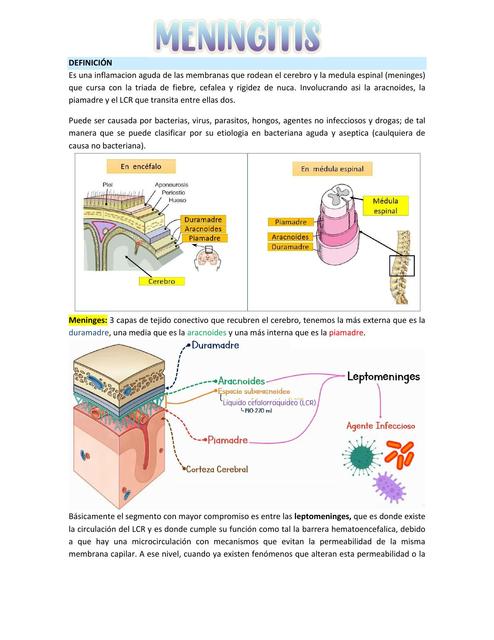 Meningitis en Pediatría