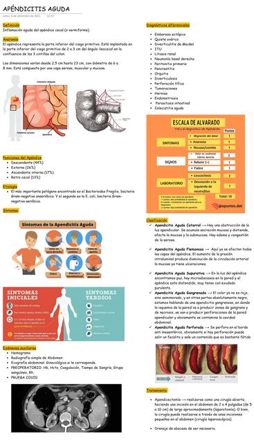 Apendicitis Aguda 