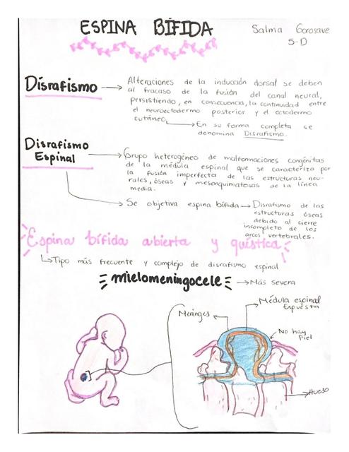 Espina Bífida Y Médula Anaclada