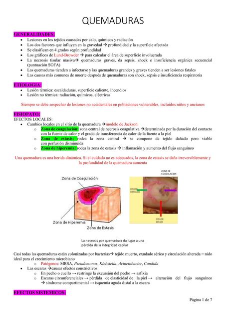 QUEMADURAS