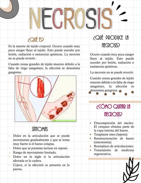 Apunte de Necrosis