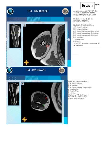 Radiografías de Locomotor