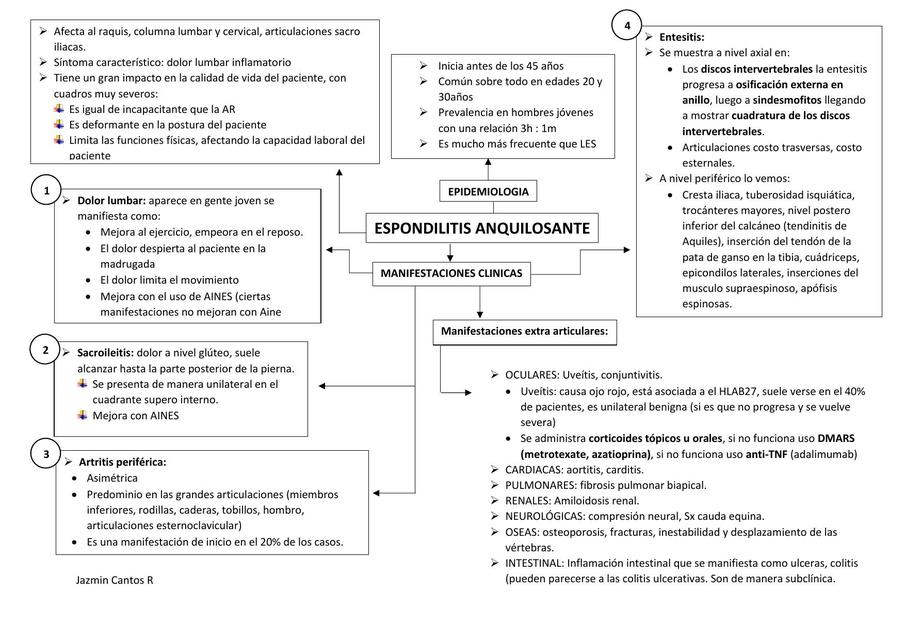 Espondilitis Anquilosante 