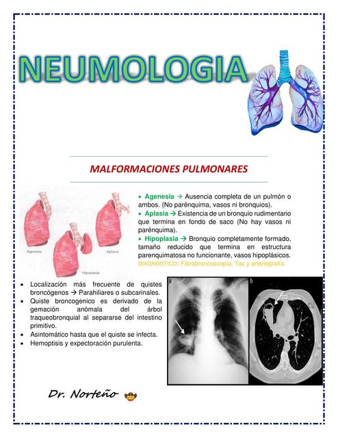 Neumología