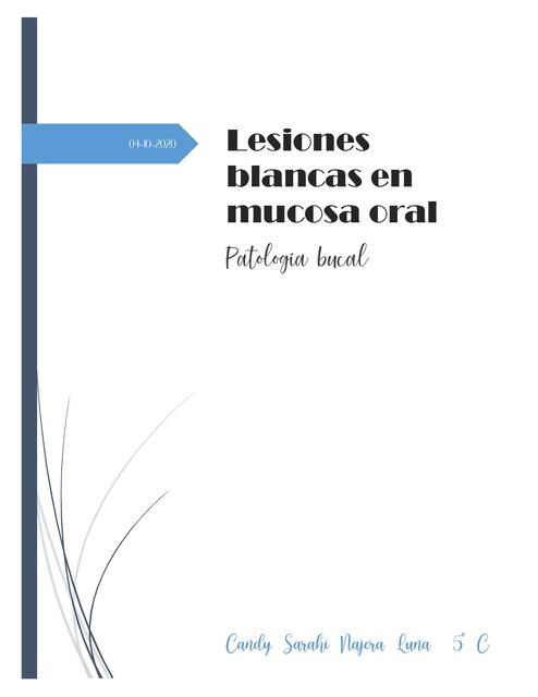 Lesiones Blancas de la Mucosa Bucal