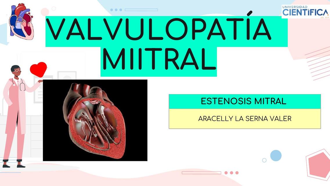 Valvulopatía Mitral 