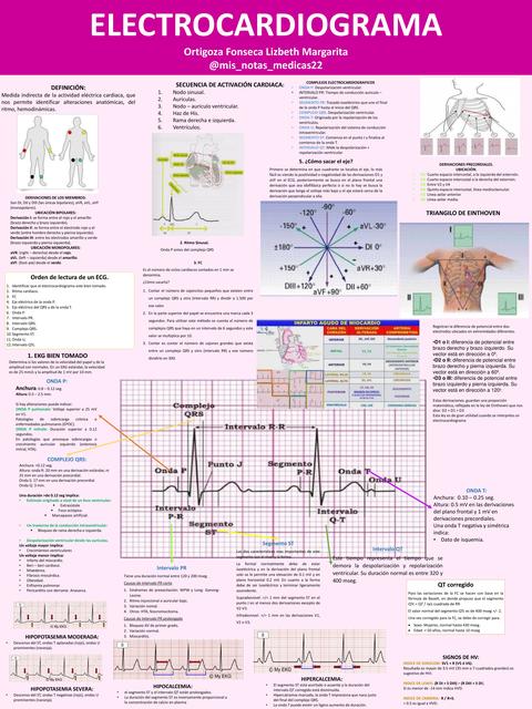 Interpretación de Electrocardiograma