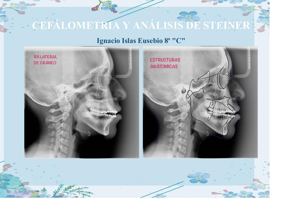 Cefalometria y Análisis de Steiner