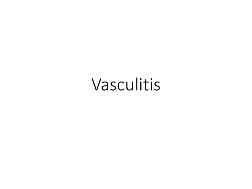 Vasculitis