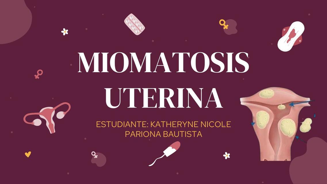 Miomatosis Uterina