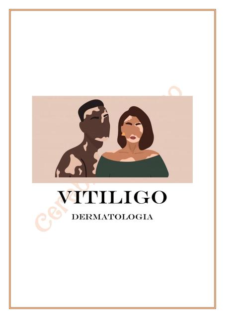 Vitiligo