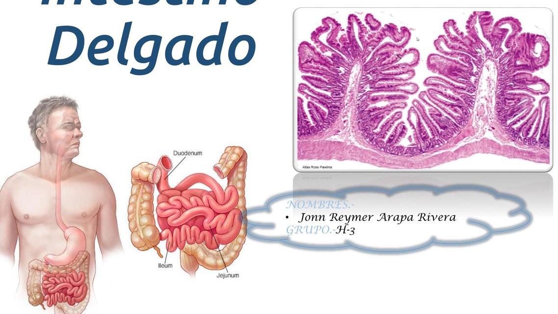 Intestino Delgado