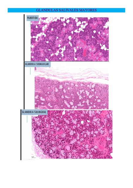 Glándulas Salivales Mayores 