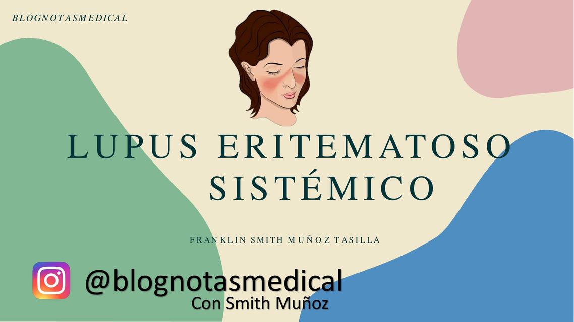 Lupus eritematoso sistémico