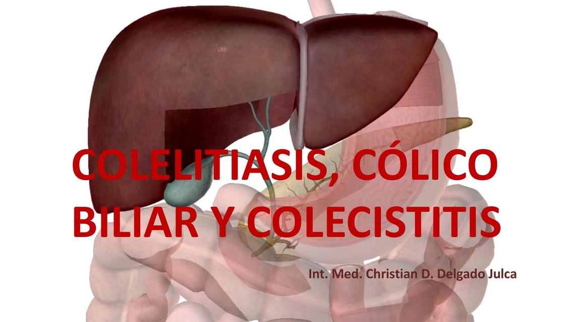 Colelitiasis Cólico Biliar Y Colecistitis Christian Delgado Julca