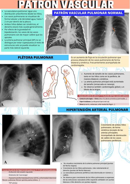 Patrón Vascular 