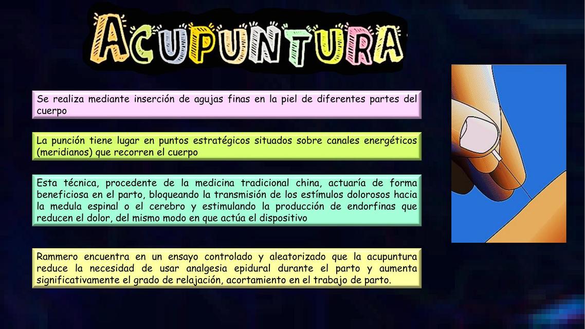 Acupuntura 