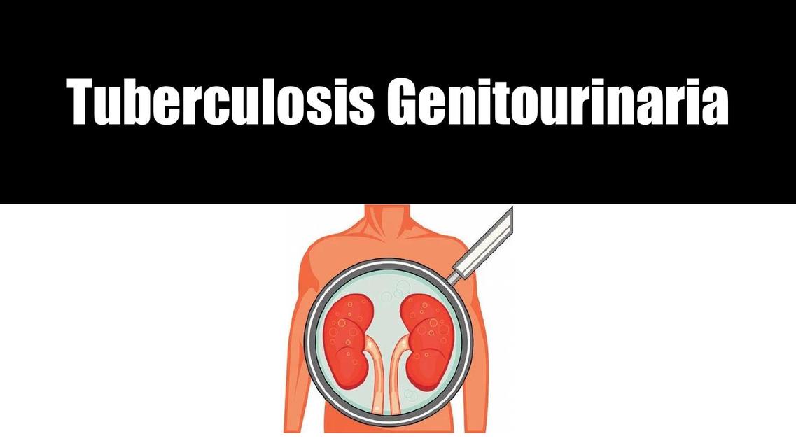 Tuberculosis Genitourinaria 