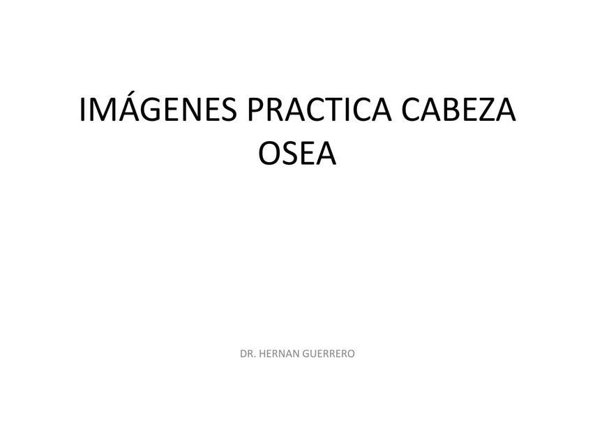 IMÁGENES PRACTICA CABEZA OSEA