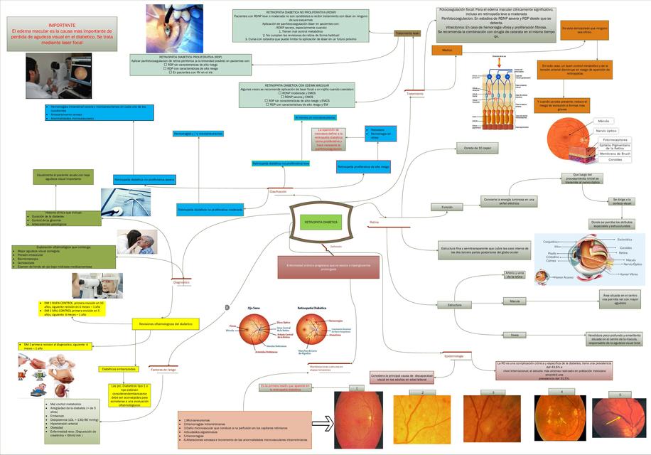 Retinopatía Diabética 