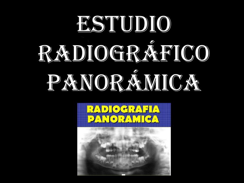 TECNICA RADIOGRAFICA PANORAMICA