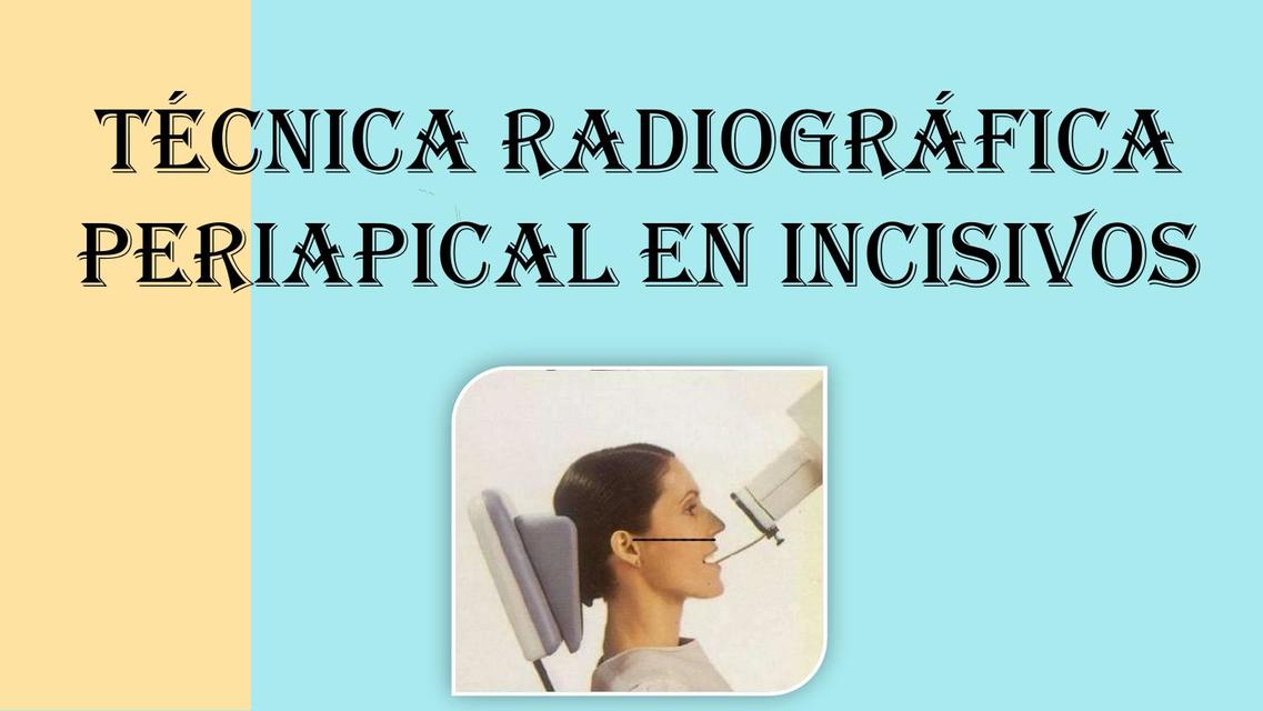 Técnica radiográfica periapical en incisivos