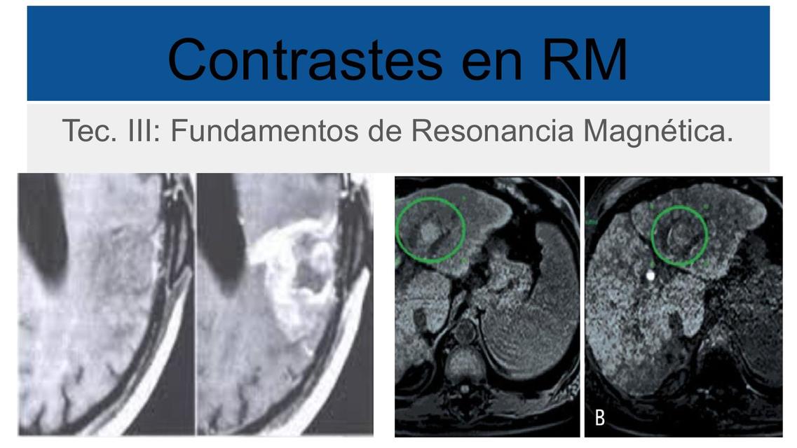 Contraste en RM