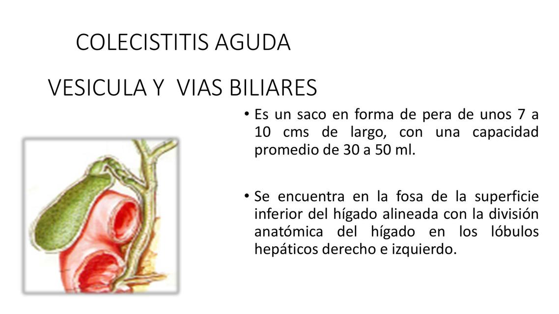 Colecistitis Aguda 