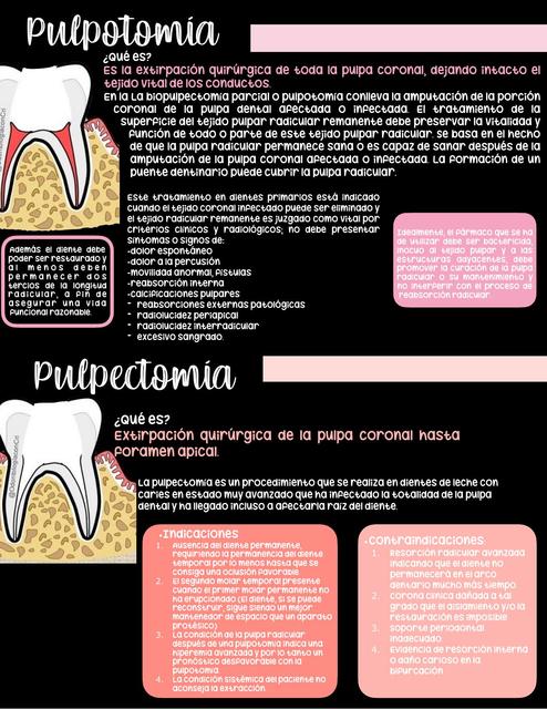 Pulpectomía y Pulpotomía