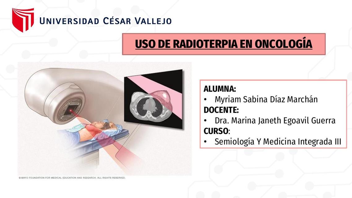 Radioterapia 