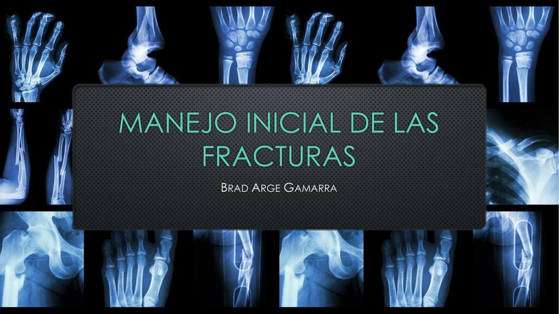 Manejo inicial de las fracturas