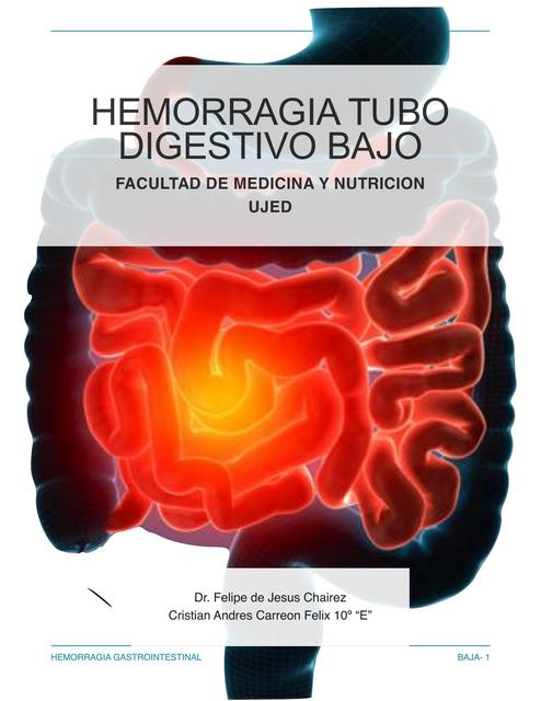 Hemorragia Tubo Digestivo Bajo 