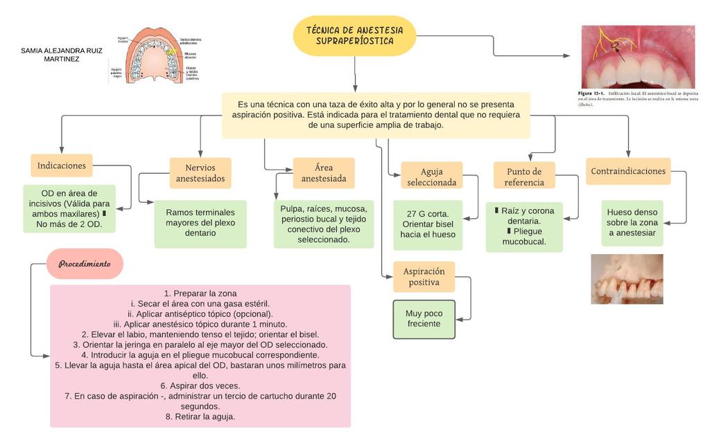 Técnicas de Anestesia