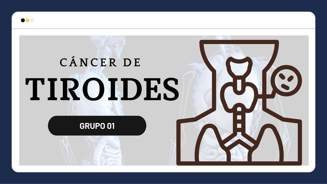 Cáncer de Tiroides