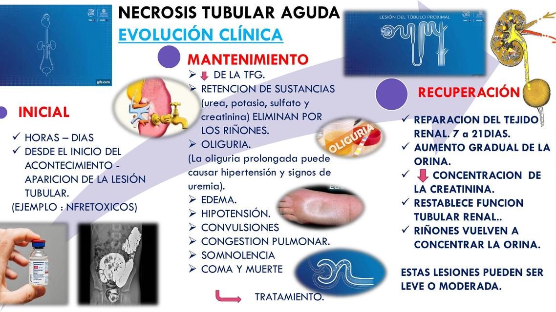 EVOLUCIón Necrosis Tubular Aguda