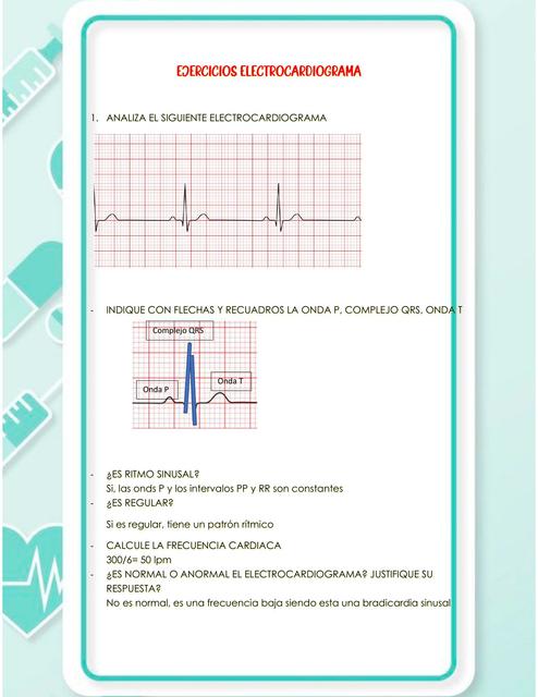 Ejercicios Electrocardiograma 