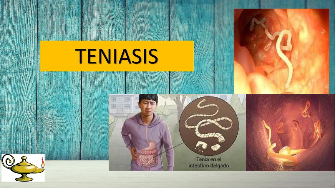 Teniasis 