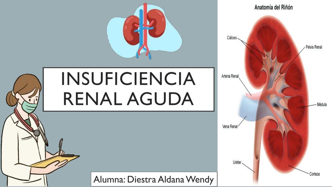 Insuficiencia Renal Aguda