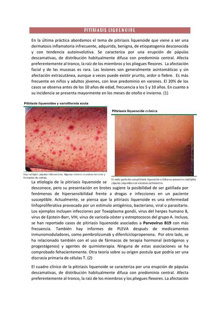 Pitiriasis Liquenoide