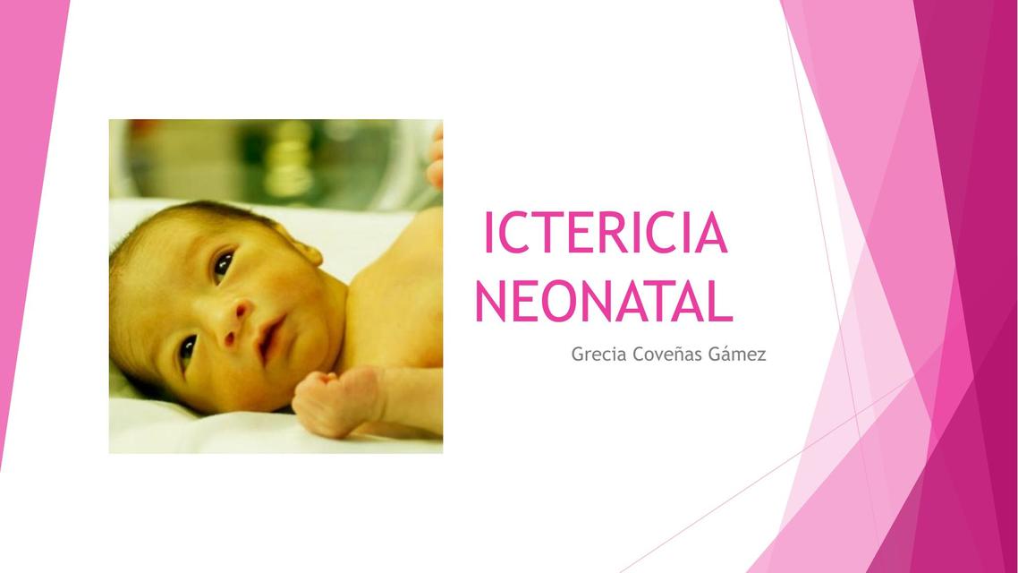 Ictericia Neonatal 