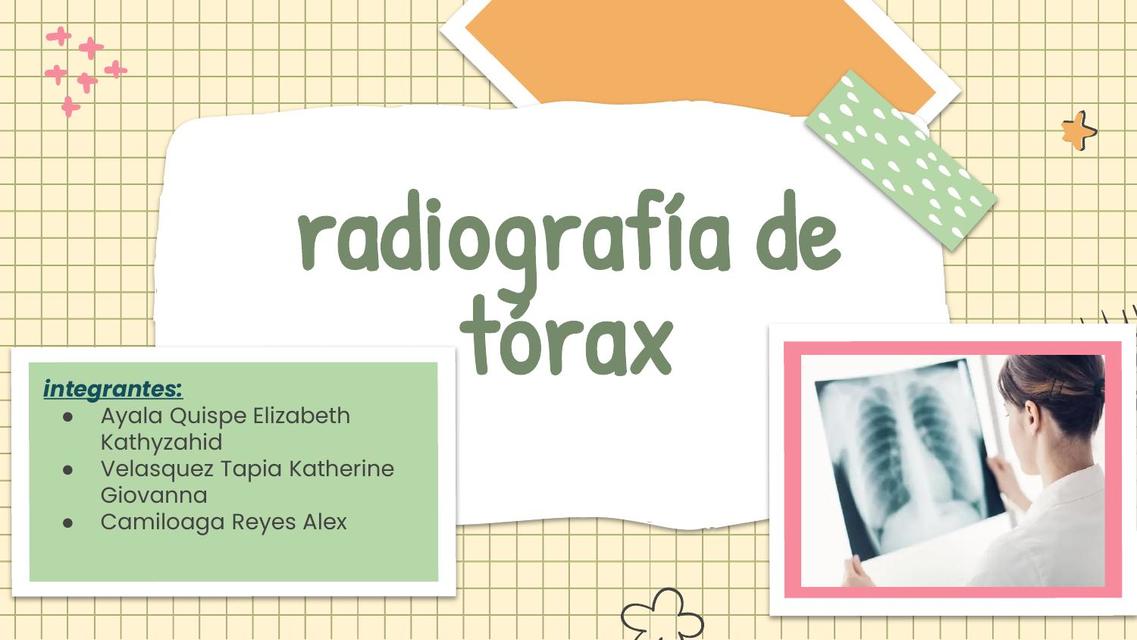 Radiografía de Tórax